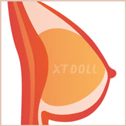 Gel Breasts